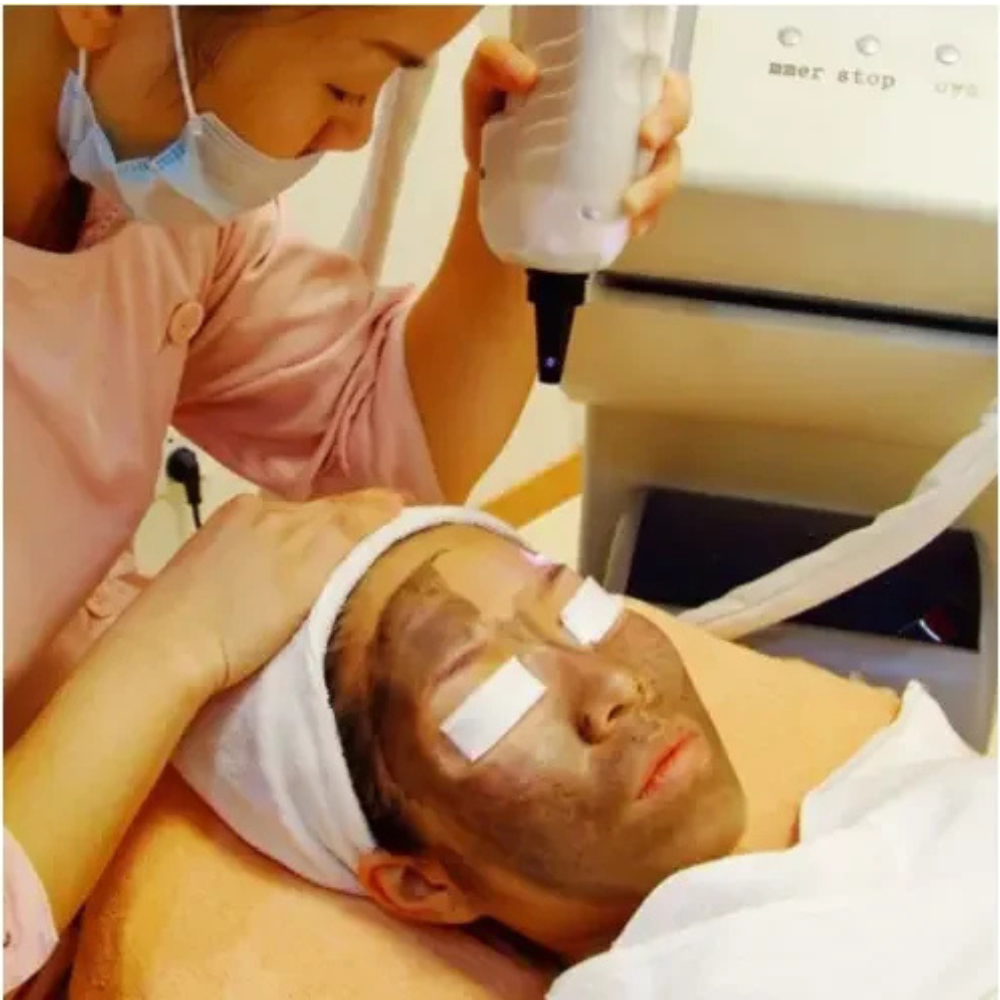 Carbon Peeling Black Doll Treatment Gel – Nd YAG Laser Carbon Peel Cream - Image 4