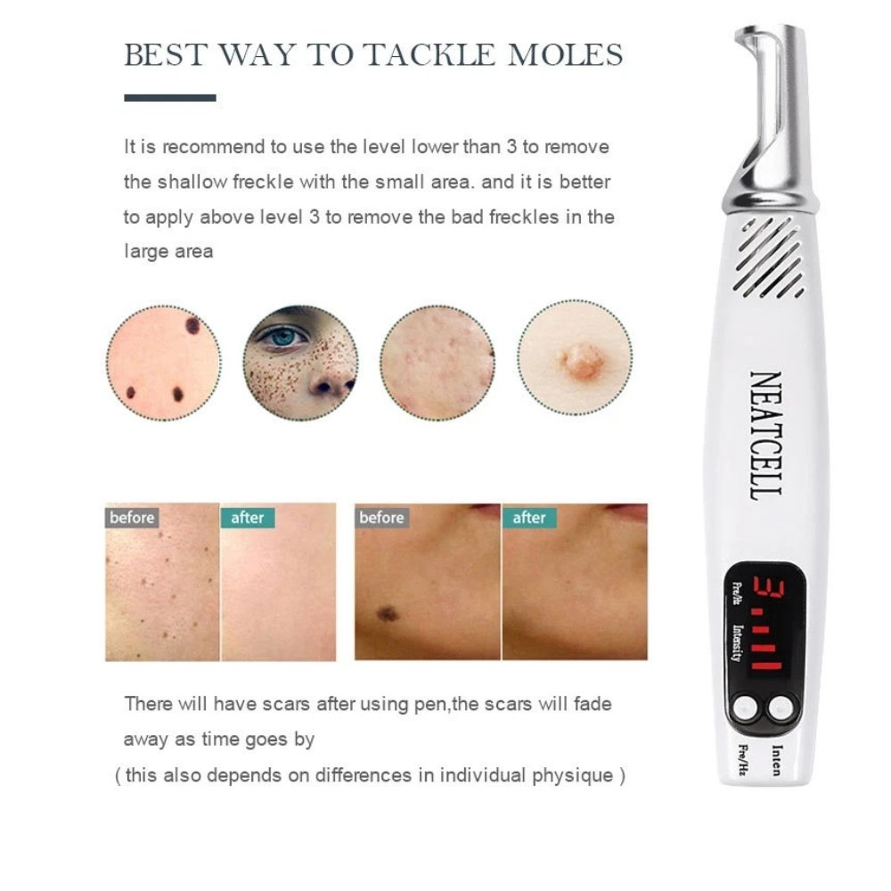 Picosecond Laser Pen Blue and Red Light – Mini Laser Freckle Removal Machine - Image 2